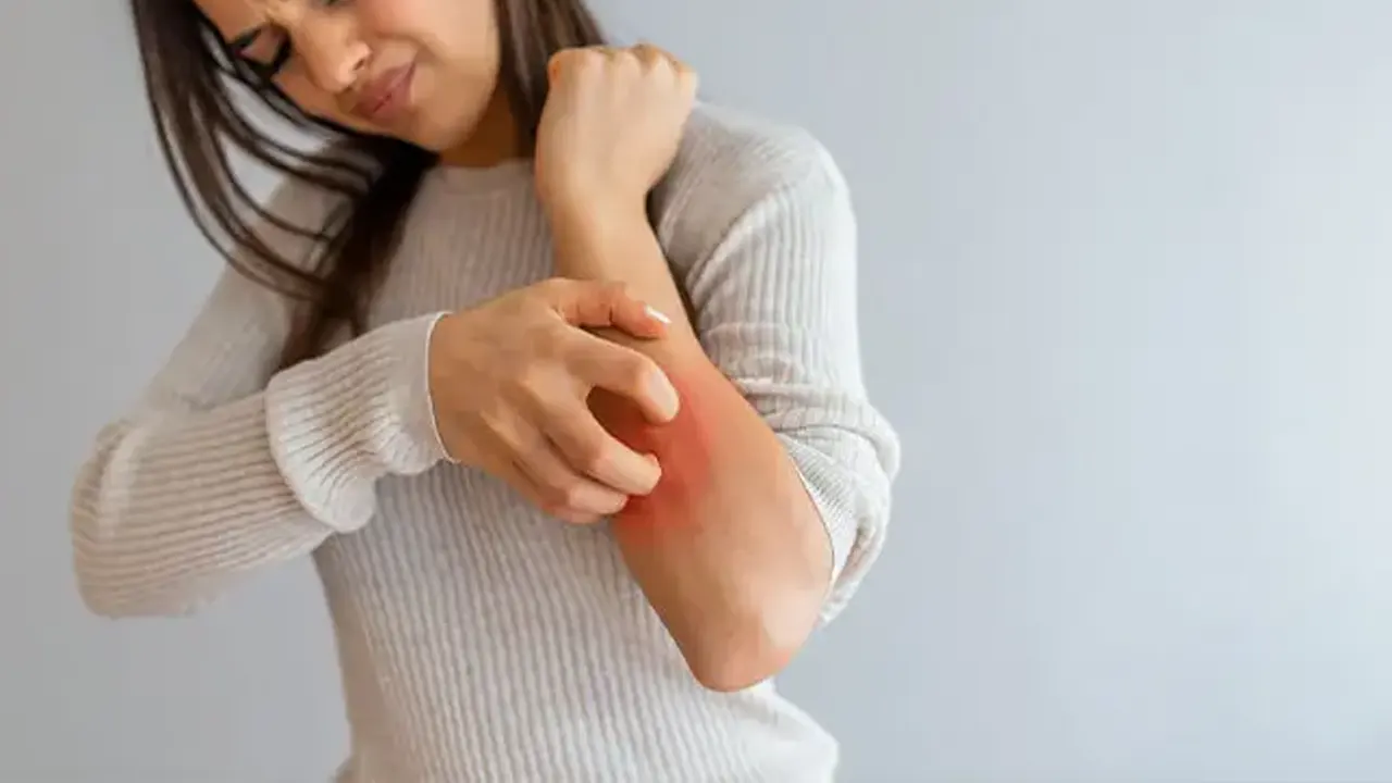 চুলকানি শুধু ত্বকের সমস্যা নয়, হতে পারে বড় অসুখের সংকেত