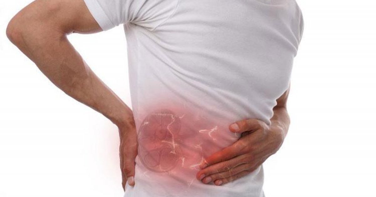 কিডনিতে পাথর হয়েছে কিনা বুঝবেন যেভাবে